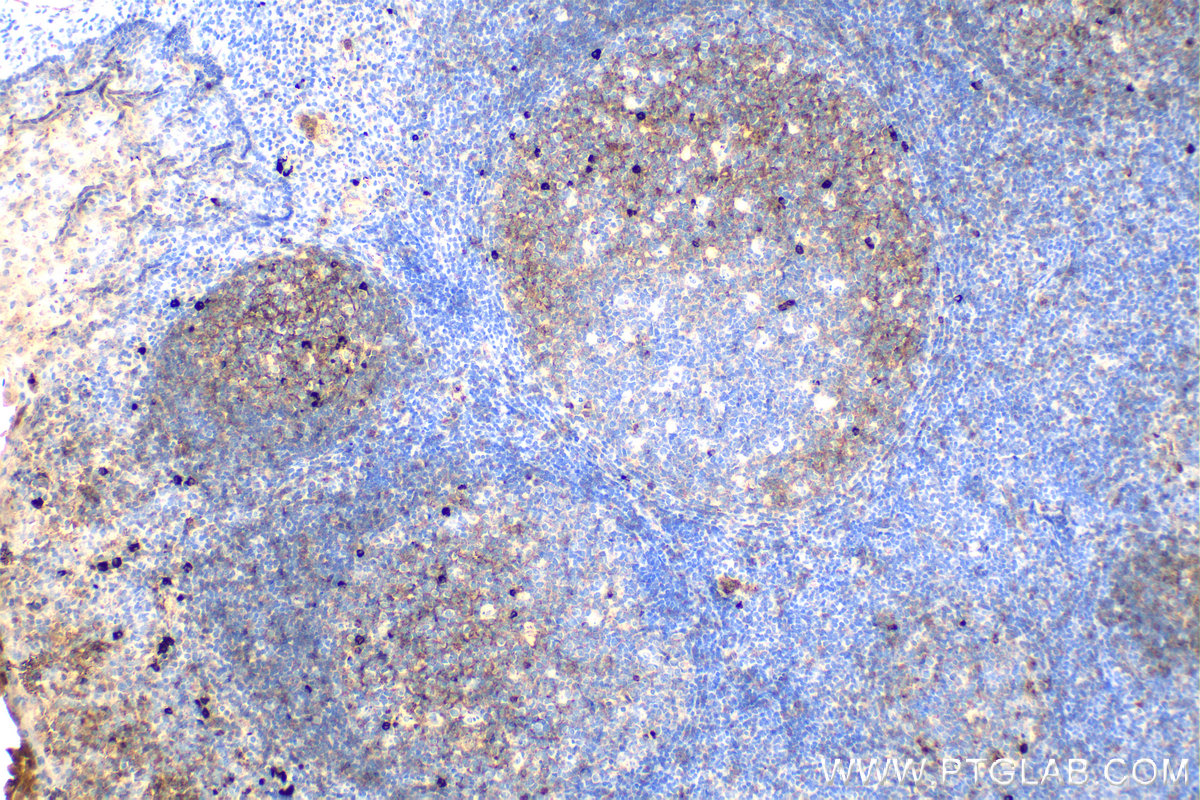 Immunohistochemistry (IHC) staining of human tonsillitis tissue using human IgM Monoclonal antibody (66484-1-Ig)