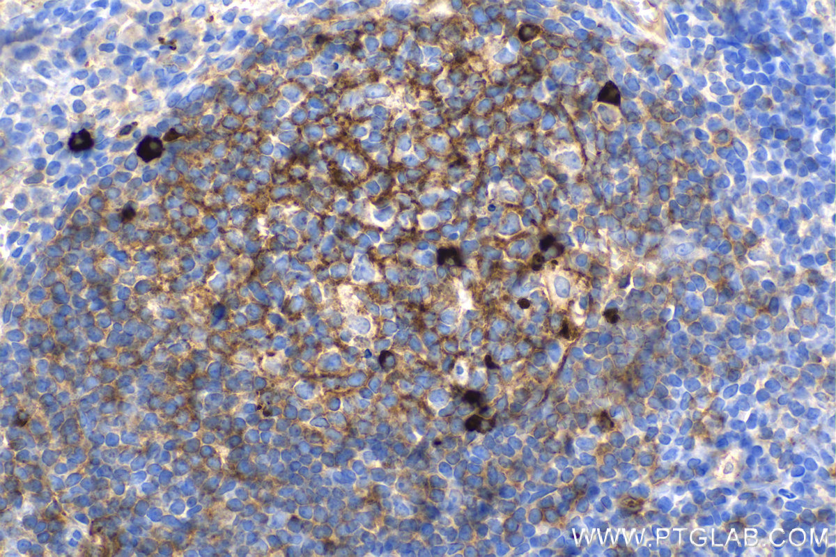 Immunohistochemistry (IHC) staining of human tonsillitis tissue using human IgM Monoclonal antibody (66484-1-Ig)