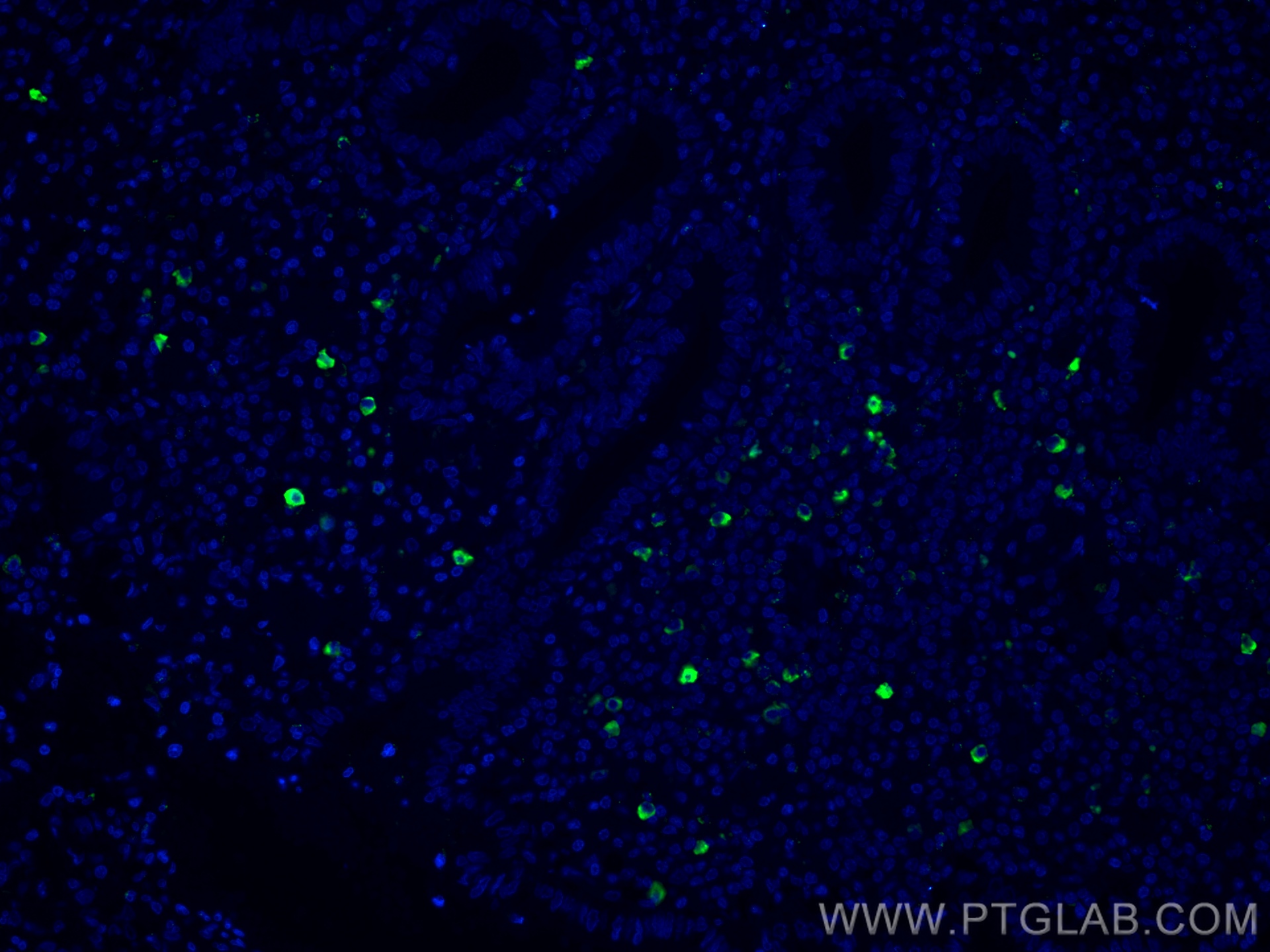 Immunofluorescence (IF) / fluorescent staining of human appendicitis tissue using CoraLite® Plus 488-conjugated human IgM Monoclonal (CL488-66484)