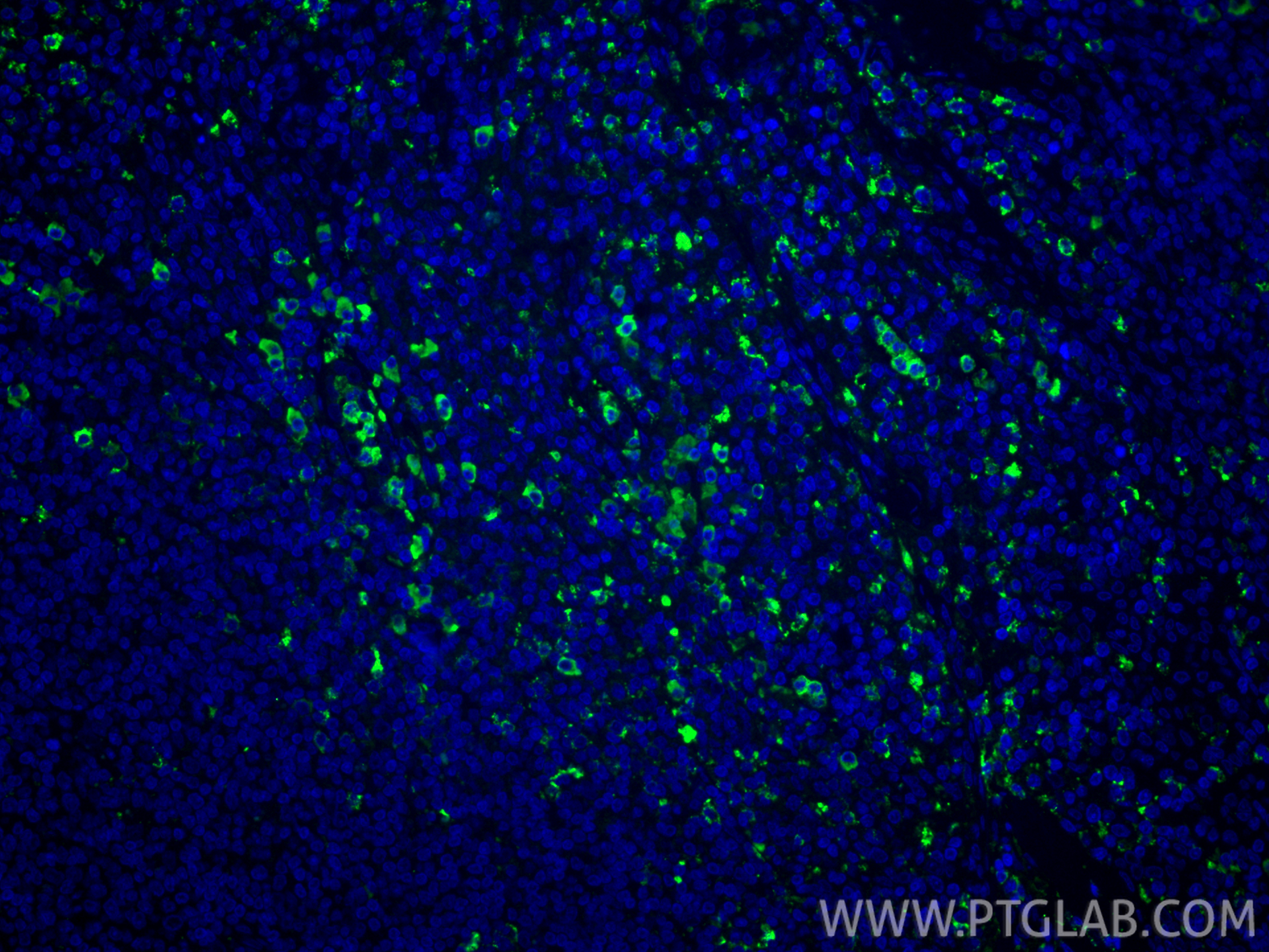 Immunofluorescence (IF) / fluorescent staining of human tonsillitis tissue using IgG Kappa Light Chain Polyclonal antibody (11781-1-AP)