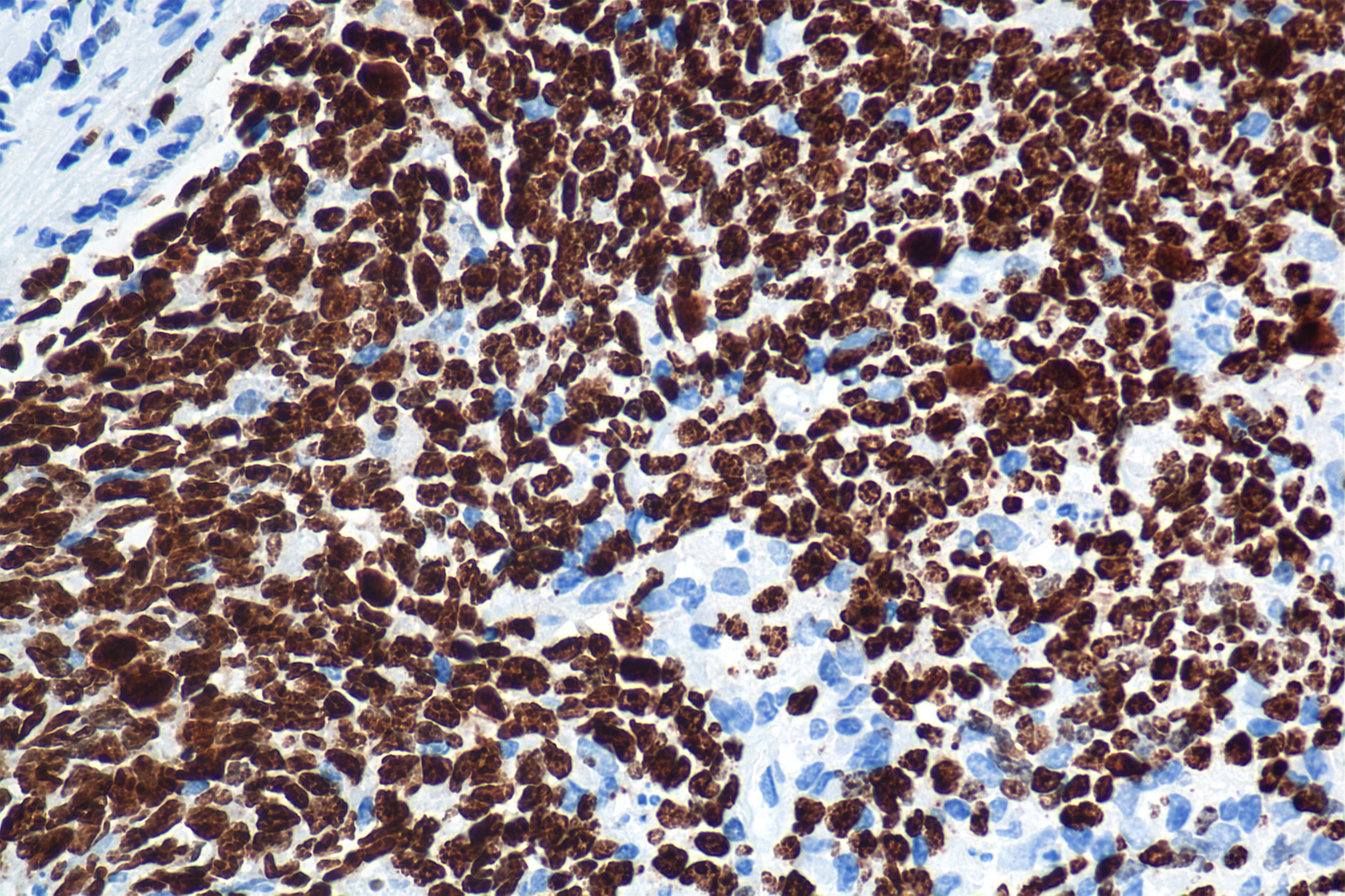 Immunohistochemical analysis of paraffin-embedded mouse heart tissue slide using HRP-PF00030 (HRP Streptavidin) at dilution of 1:500 (under 40X lens). Heat mediated antigen retrieval with Tris-EDTA buffer (pH 9.0).
Primary antibody is Biotin-conjugated Ki-67 Recombinant monoclonal antibody. Immunohistochemical analysis of paraffin-embedded mouse heart tissue slide using HRP-PF00030 (HRP Streptavidin) at dilution of 1:500 (under 40X lens). Heat mediated antigen retrieval with Tris-EDTA buffer (pH 9.0).
Primary antibody is Biotin-conjugated Ki-67 Recombinant monoclonal antibody.