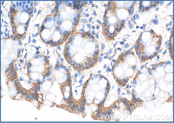 Immunohistochemical analysis of paraffin-embedded mouse colon tissue slide with anti-E-cadherin  ​Antibody(20874-1-AP) labeled with FlexAble HRP Antibody Labeling Kit for Rabbit IgG (KFA005). Antibody used at a dilution of 1:1000 under 10x and 40x lens.  Heat mediated antigen retrieval performed with Tris-EDTA buffer (pH 9.0) and DAB substrate was used for detection.
