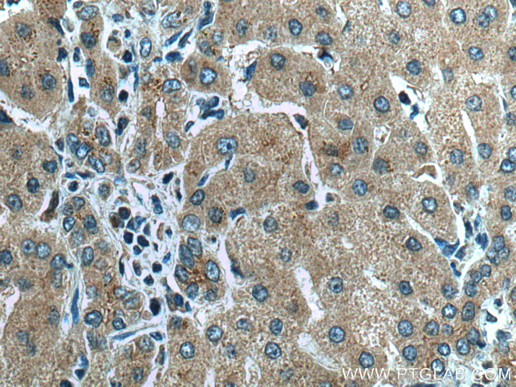 Immunohistochemical analysis of paraffin-embedded human liver tissue slide using 20886-1-AP (AIFM2/ FSP1 antibody) at dilution of 1:200 (under 40x lens). Heat mediated antigen retrieval with Tris-EDTA buffer (pH 9.0).