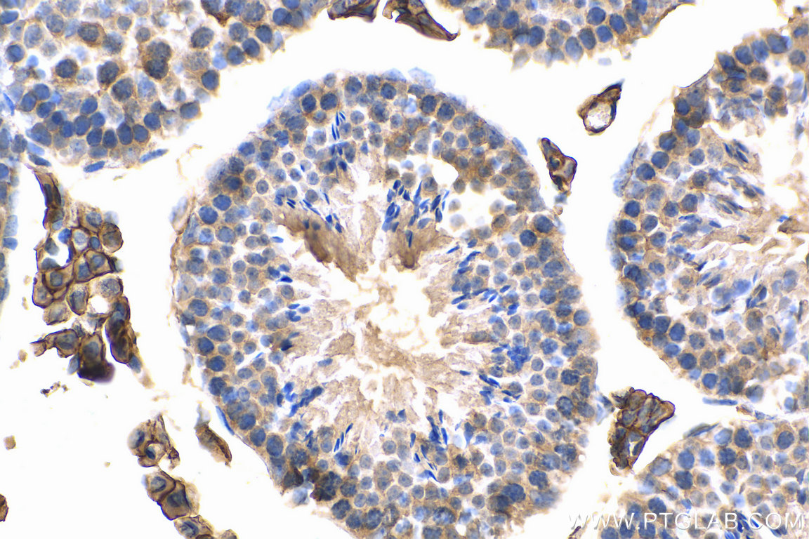 Immunohistochemical analysis of paraffin-embedded mouse testis tissue slide using 15193-1-AP (CD98/SLC3A2 antibody) at dilution of 1:200 (under 40x lens). Heat mediated antigen retrieval with Tris-EDTA buffer (pH 9.0).