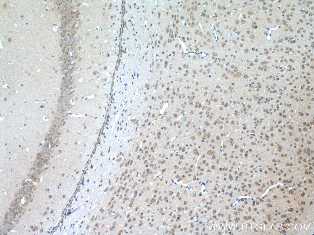 Immunohistochemical analysis of paraffin-embedded mouse brain tissue slide using 20507-1-AP (SLC11A2 antibody) at dilution of 1:200 (under 10x lens. Heat mediated antigen retrieval with Tris-EDTA buffer (pH 9.0).