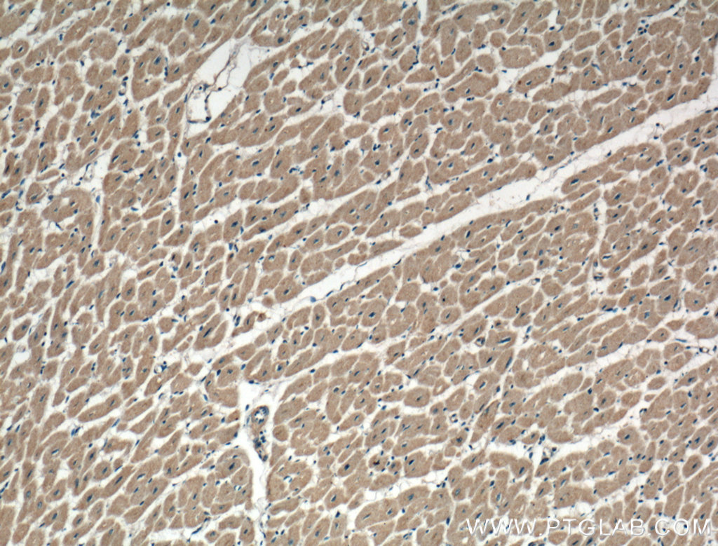 Immunohistochemical analysis of paraffin-embedded human heart tissue slide using 26276-1-AP (ATG9A Antibody) at dilution of 1:100 (under 10x lens).