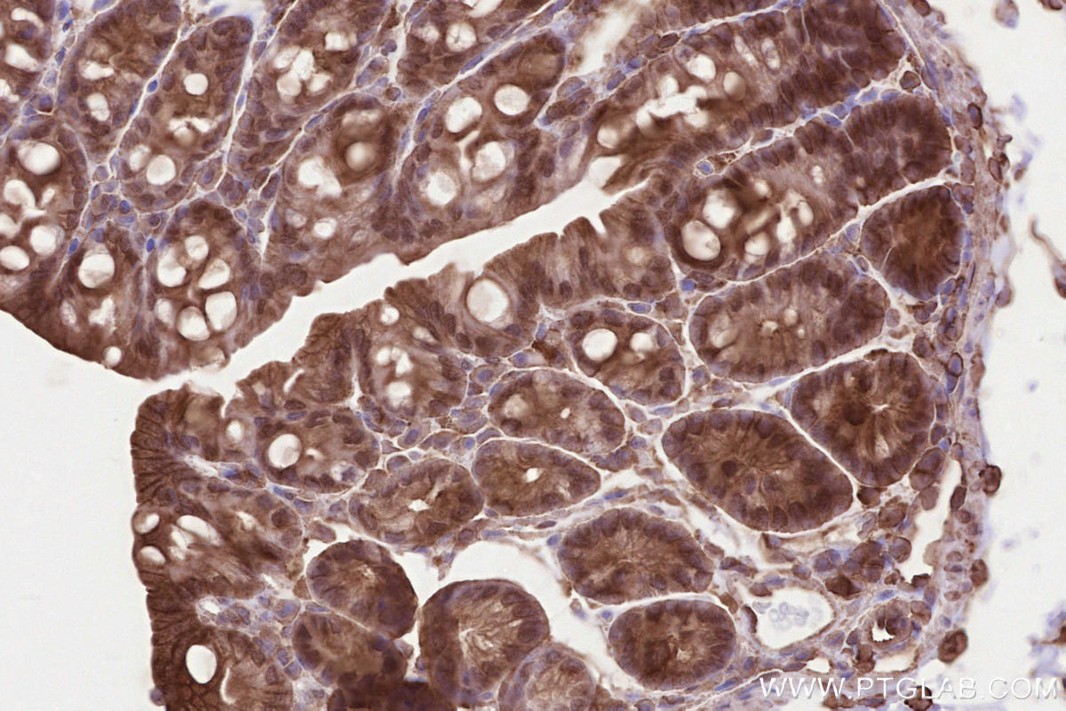 Immunohistochemical analysis of paraffin-embedded mouse colon tissue slide using KHC2588 (AAGAB IHC Kit).