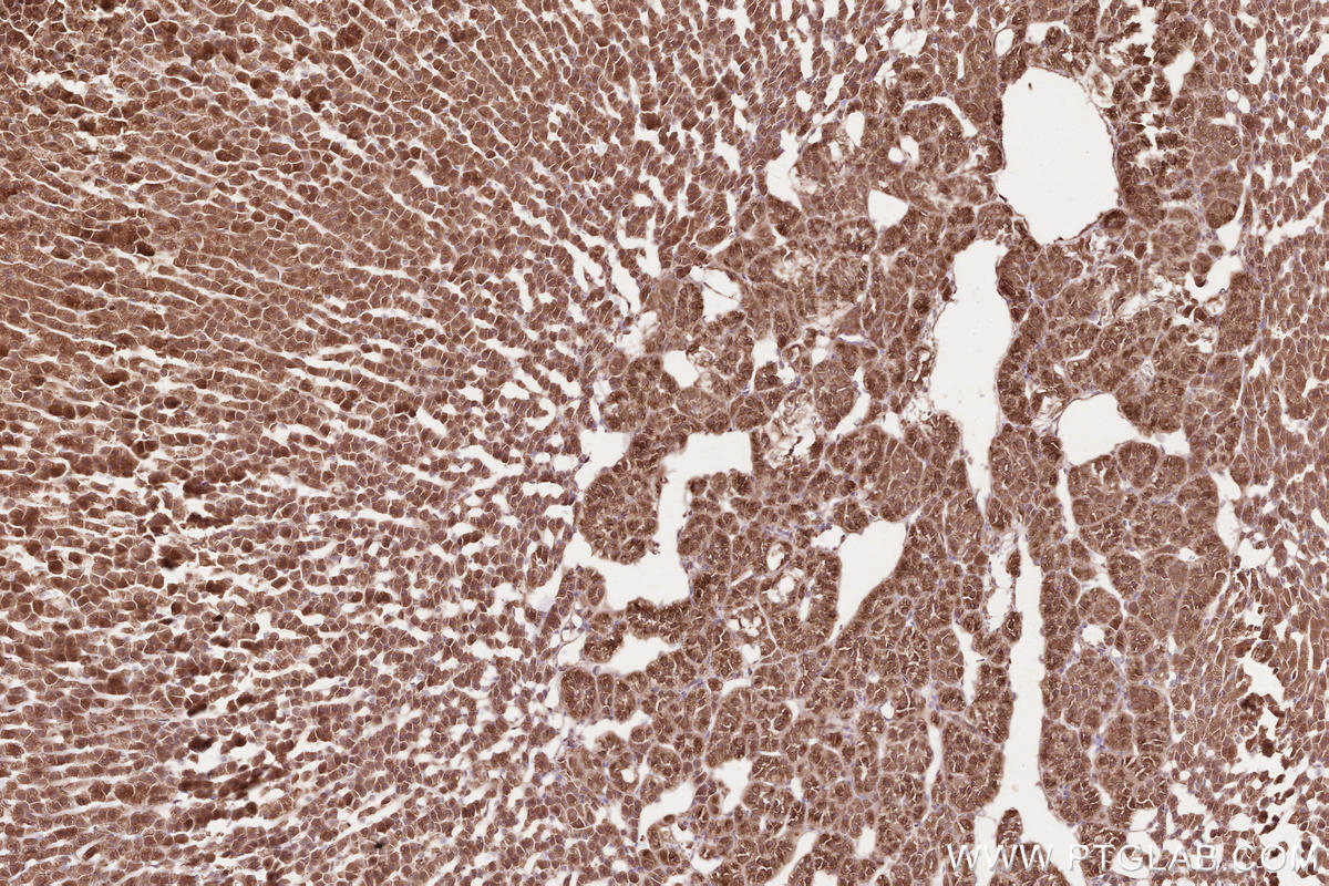 Immunohistochemical analysis of paraffin-embedded rat adrenal gland tissue slide using KHC2588 (AAGAB IHC Kit).