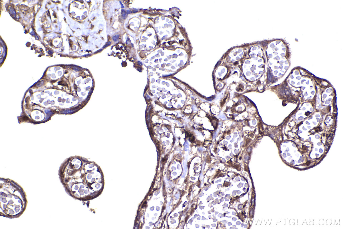 Immunohistochemical analysis of paraffin-embedded human placenta tissue slide using KHC2240 (ABCD1 IHC Kit).