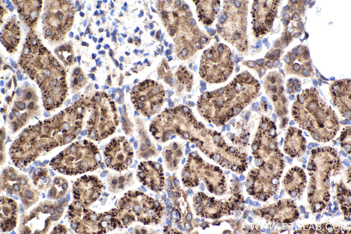 Immunohistochemical analysis of paraffin-embedded rat kidney tissue slide using KHC2240 (ABCD1 IHC Kit).