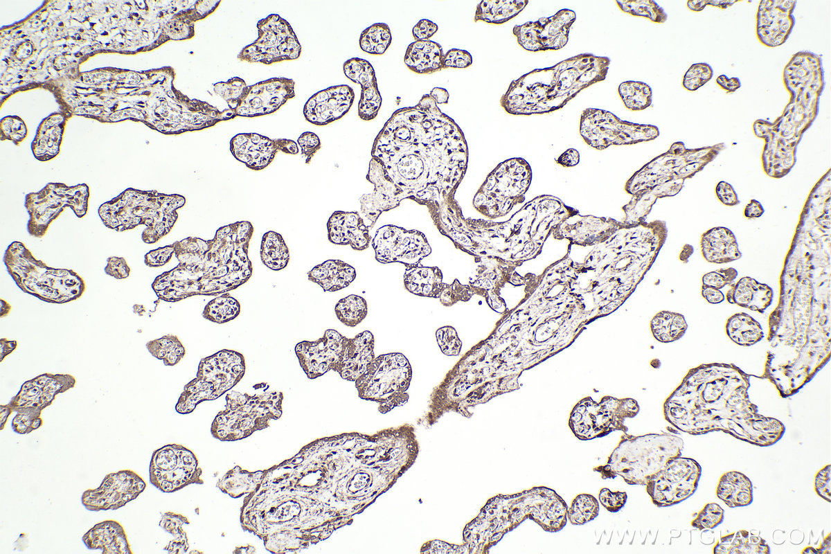 Immunohistochemical analysis of paraffin-embedded human placenta tissue slide using KHC2216 (ABCD3 IHC Kit).