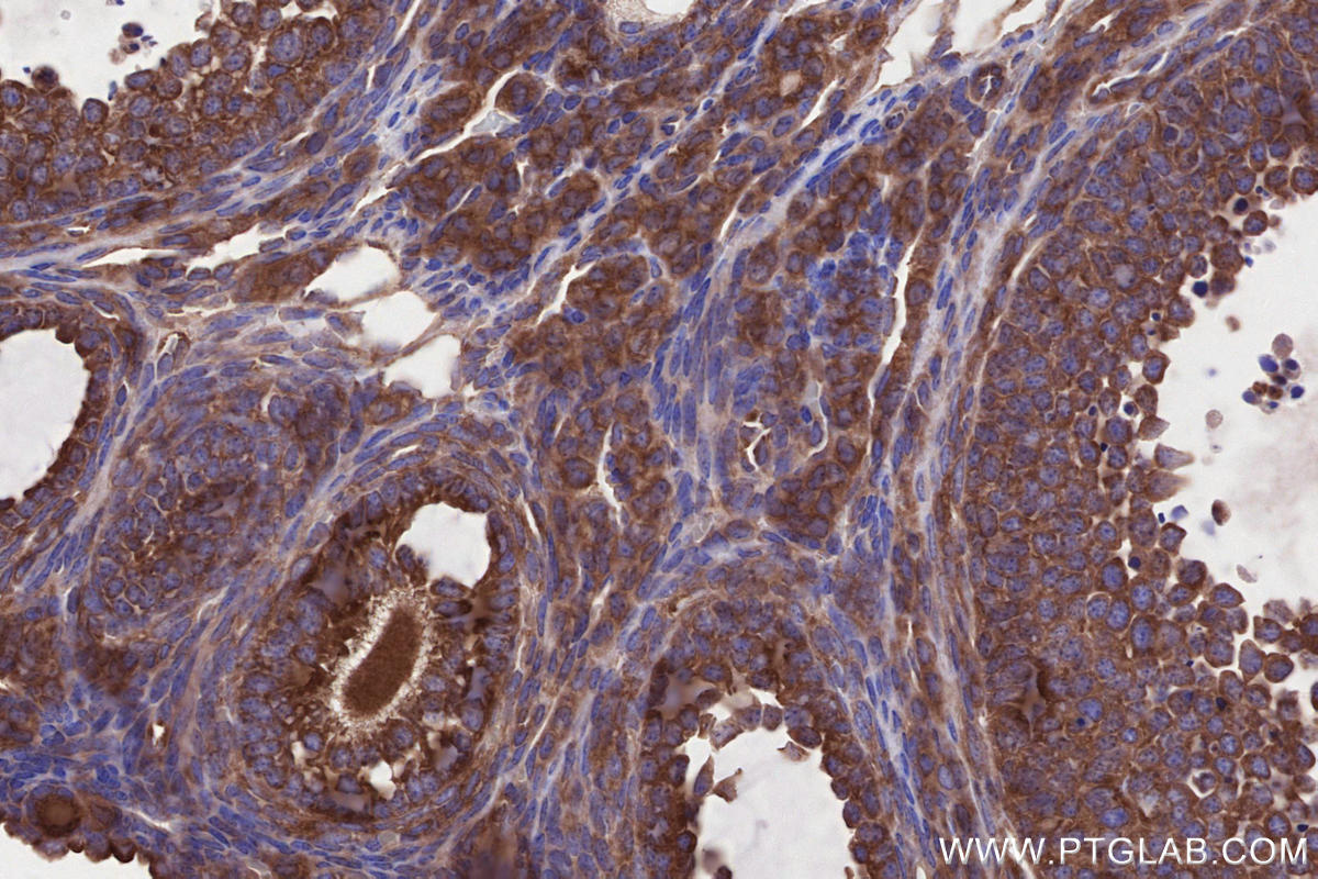 Immunohistochemical analysis of paraffin-embedded mouse ovary tissue slide using KHC2664 (ABI1 IHC Kit).