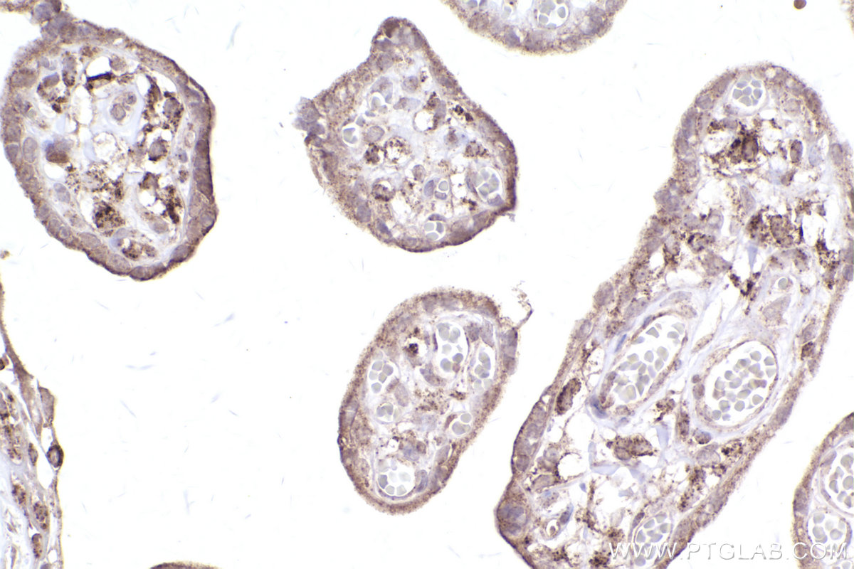 Immunohistochemical analysis of paraffin-embedded human placenta tissue slide using KHC2556 (ACBD5 IHC Kit).