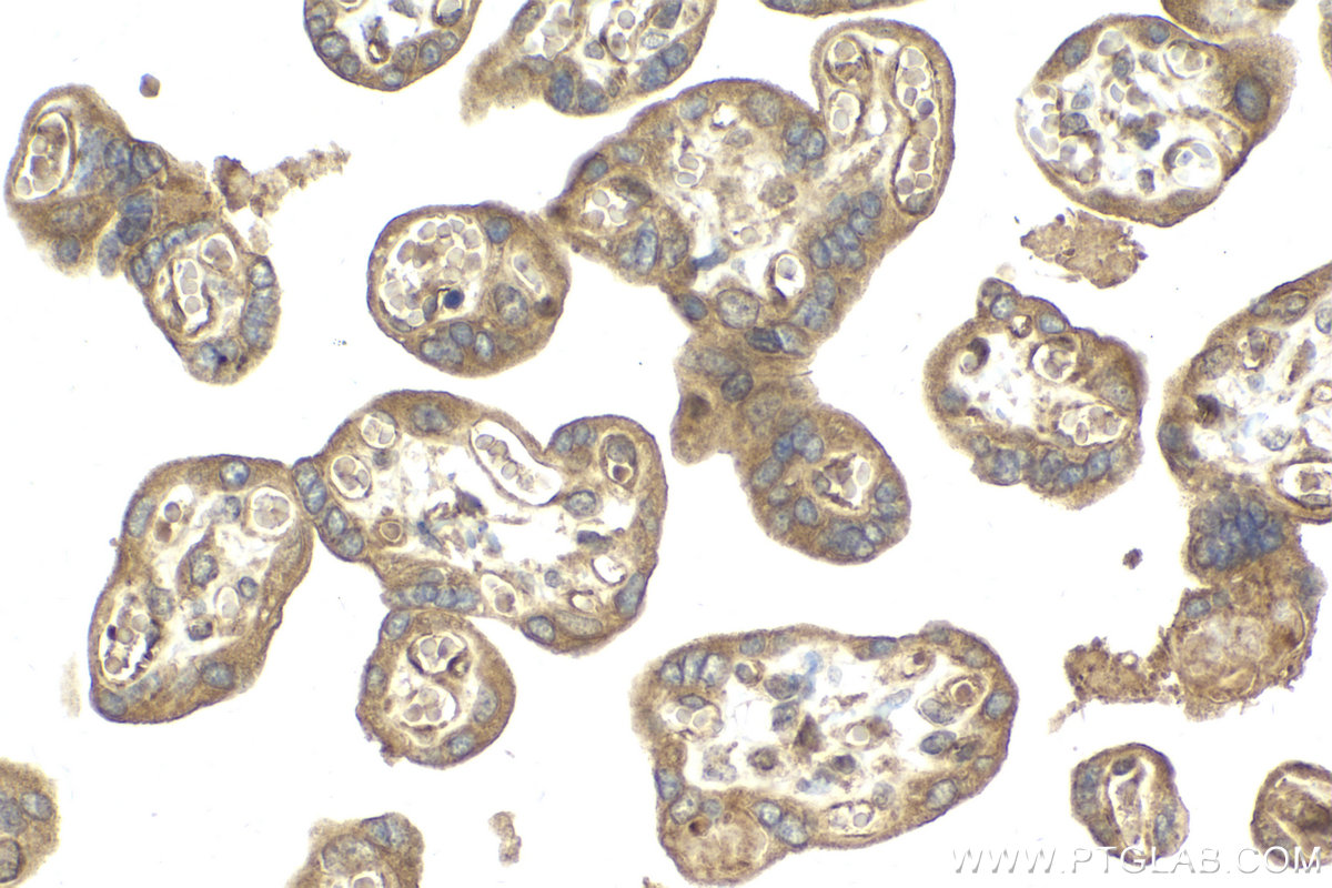 Immunohistochemical analysis of paraffin-embedded human placenta tissue slide using KHC2144 (ACSL3 IHC Kit).