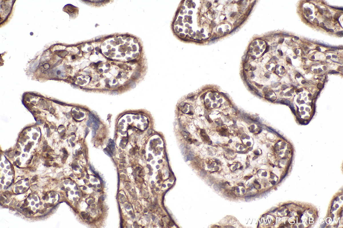 Immunohistochemical analysis of paraffin-embedded human placenta tissue slide using KHC2393 (ACVR1 IHC Kit).