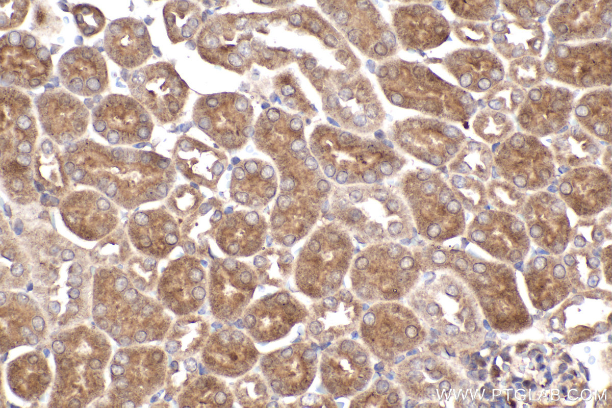 Immunohistochemical analysis of paraffin-embedded mouse kidney tissue slide using KHC2393 (ACVR1 IHC Kit).