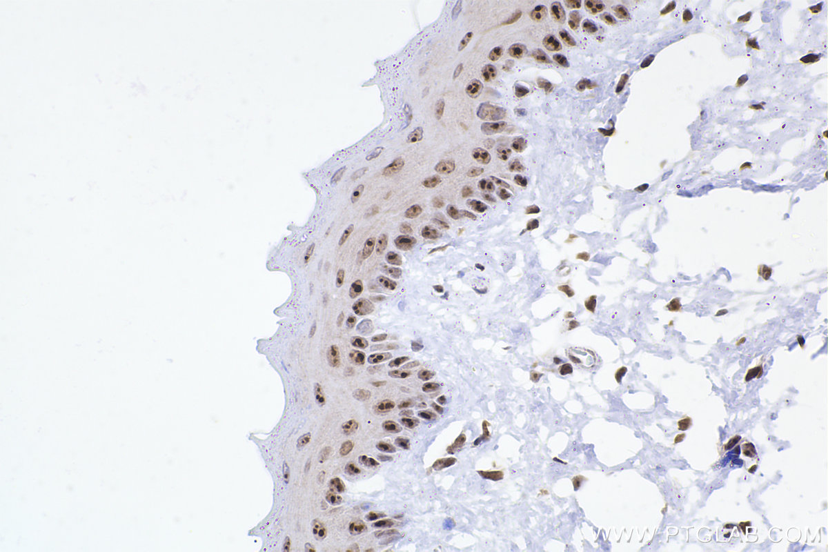 Immunohistochemical analysis of paraffin-embedded rat tongue tissue slide using KHC2368 (ADARB1 IHC Kit).