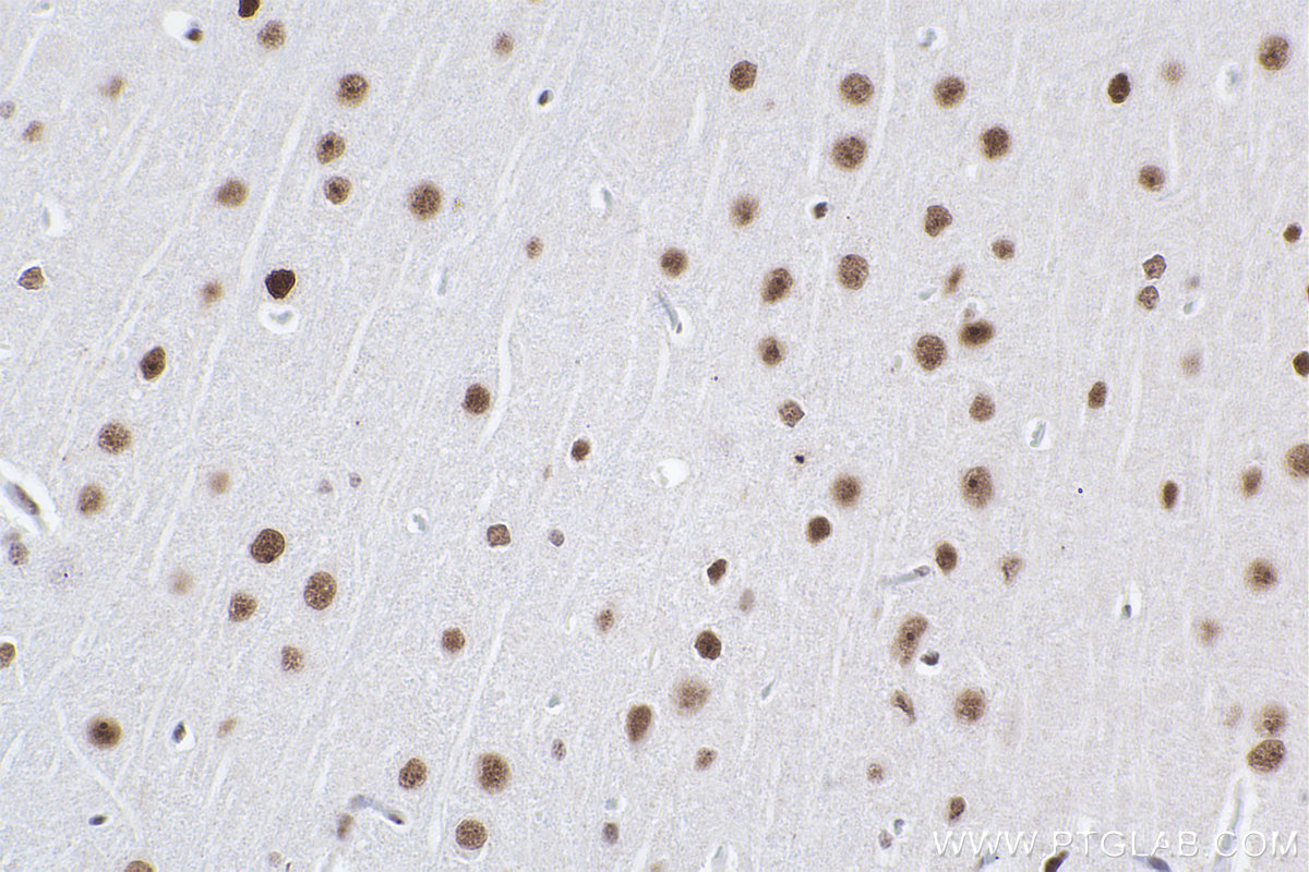 Immunohistochemical analysis of paraffin-embedded rat brain tissue slide using KHC2368 (ADARB1 IHC Kit).