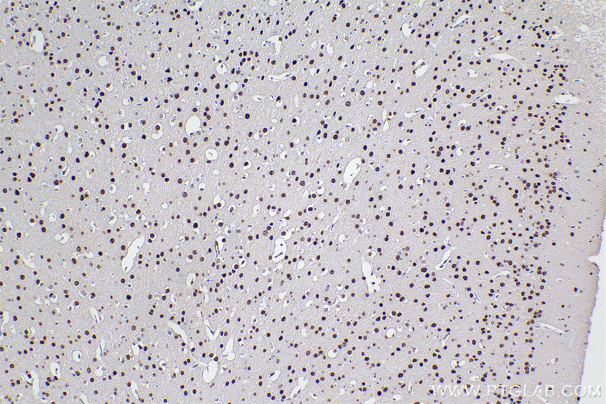 Immunohistochemical analysis of paraffin-embedded mouse brain tissue slide using KHC2368 (ADARB1 IHC Kit).