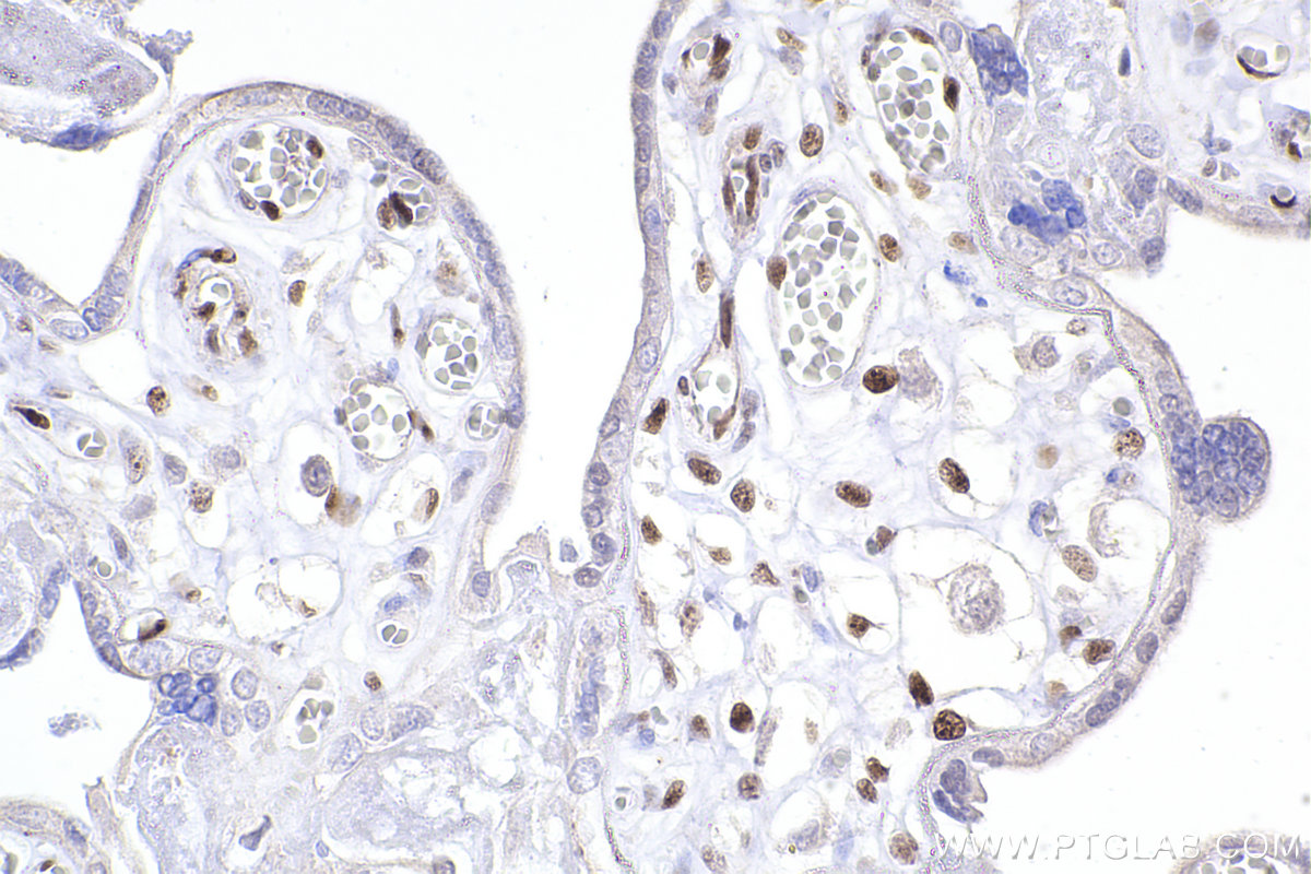 Immunohistochemical analysis of paraffin-embedded human placenta tissue slide using KHC2368 (ADARB1 IHC Kit).