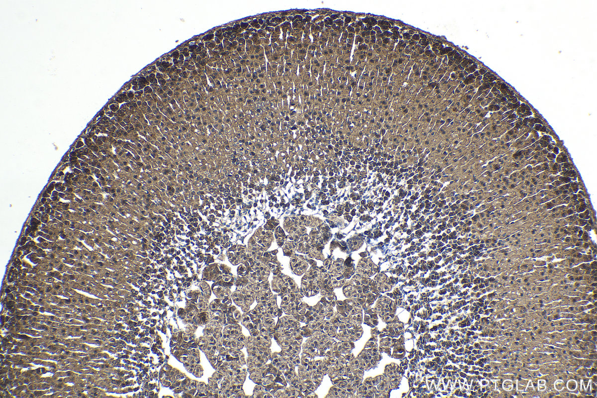 Immunohistochemical analysis of paraffin-embedded mouse adrenal gland tissue slide using KHC1459 (AIRE IHC Kit).