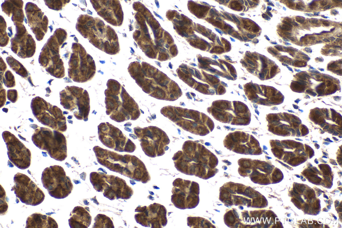 Immunohistochemical analysis of paraffin-embedded mouse stomach tissue slide using KHC2089 (AKAP10 IHC Kit).