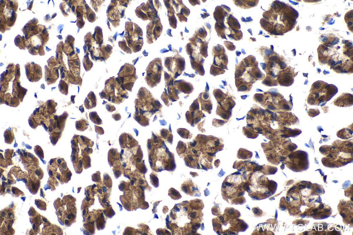 Immunohistochemical analysis of paraffin-embedded rat stomach tissue slide using KHC2089 (AKAP10 IHC Kit).