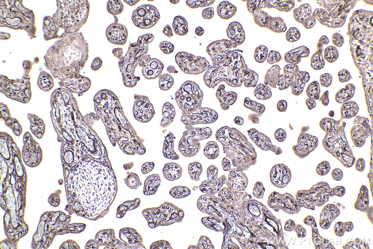 Immunohistochemical analysis of paraffin-embedded human placenta tissue slide using KHC2388 (AKAP12 IHC Kit).