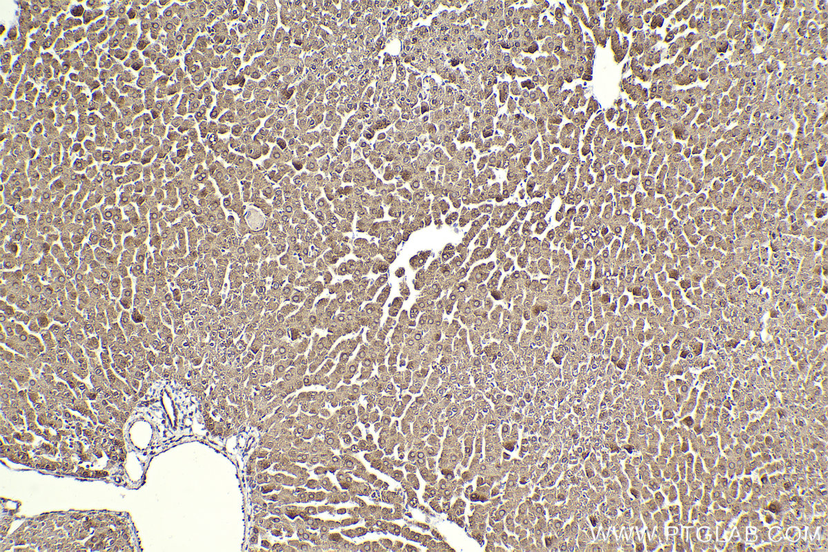 Immunohistochemical analysis of paraffin-embedded rat liver tissue slide using KHC2305 (ALDH3A2 IHC Kit).