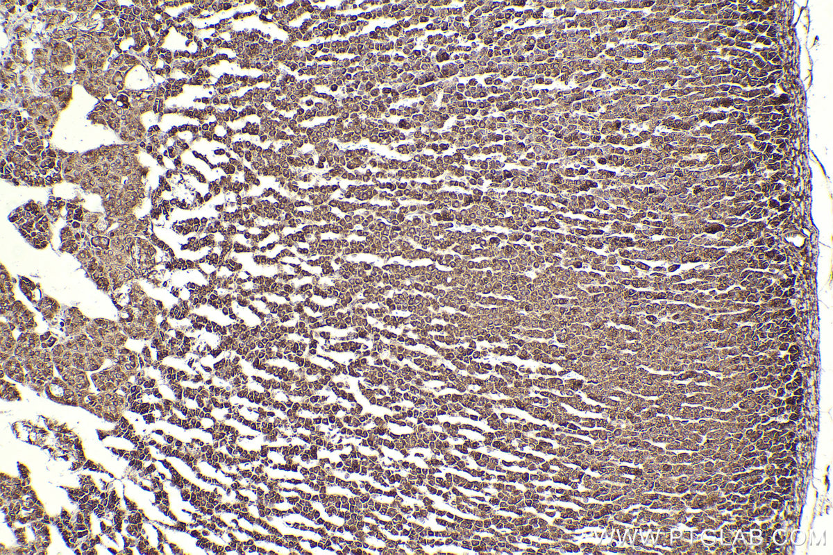 Immunohistochemical analysis of paraffin-embedded rat adrenal gland tissue slide using KHC2305 (ALDH3A2 IHC Kit).