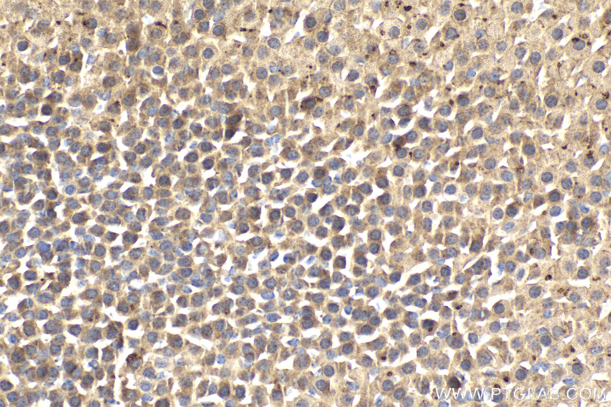 Immunohistochemical analysis of paraffin-embedded mouse adrenal gland tissue slide using KHC2160 (ALPL IHC Kit).