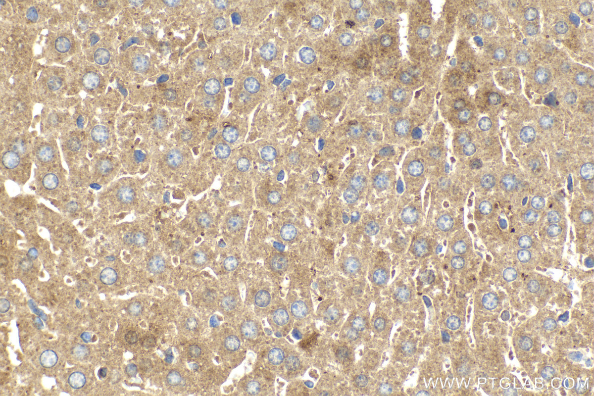 Immunohistochemical analysis of paraffin-embedded mouse liver tissue slide using KHC2160 (ALPL IHC Kit).