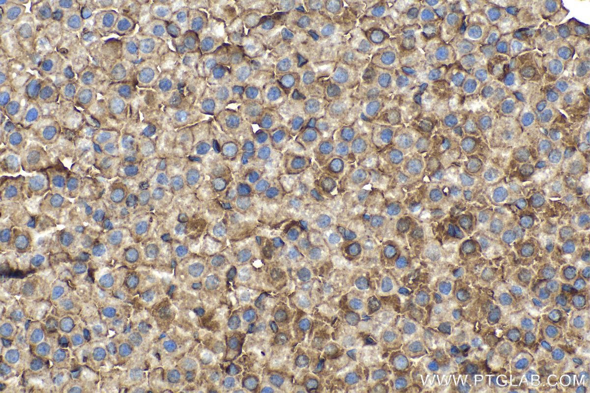 Immunohistochemical analysis of paraffin-embedded rat adrenal gland tissue slide using KHC2160 (ALPL IHC Kit).