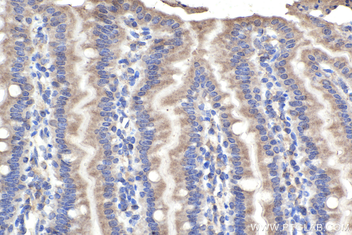 Immunohistochemical analysis of paraffin-embedded mouse small intestine tissue slide using KHC2382 (AMPD2 IHC Kit).