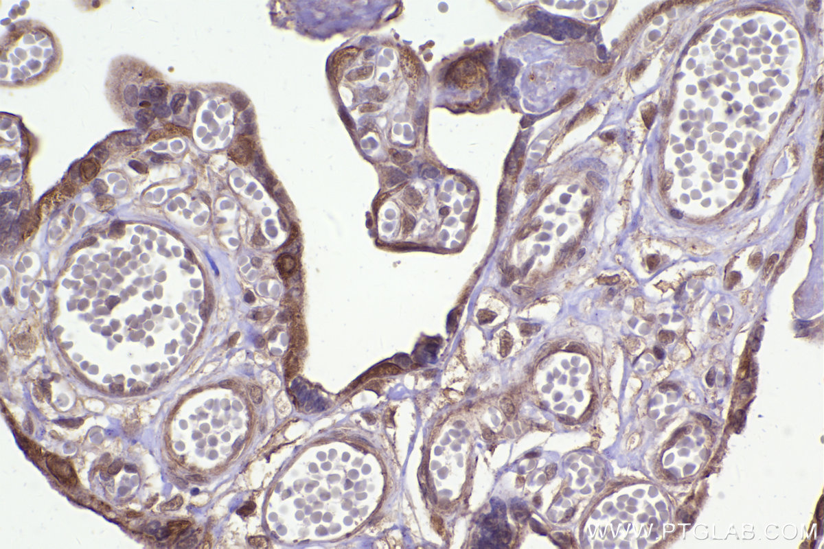 Immunohistochemical analysis of paraffin-embedded human placenta tissue slide using KHC2334 (ANAPC15 IHC Kit).