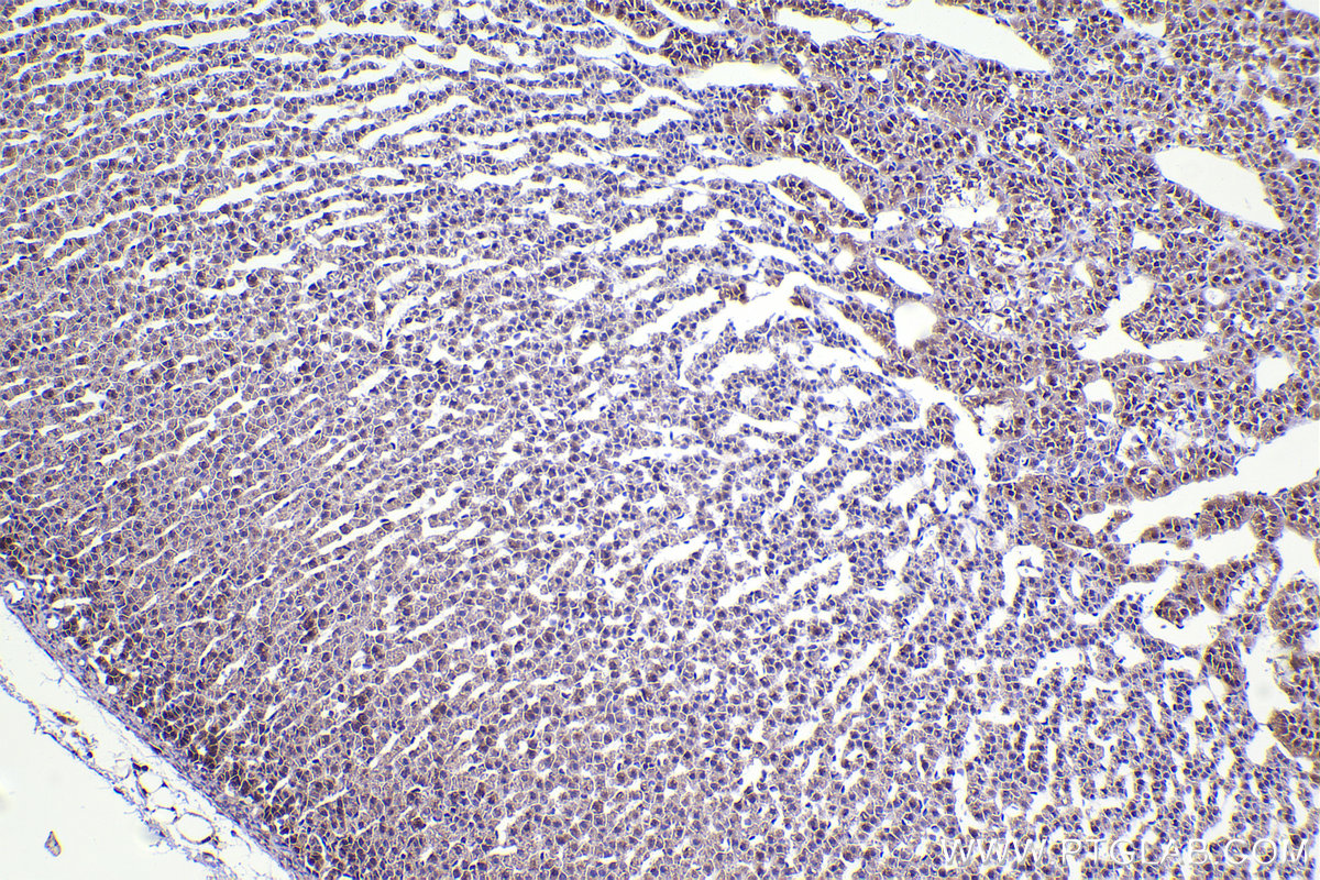 Immunohistochemical analysis of paraffin-embedded rat adrenal gland tissue slide using KHC2334 (ANAPC15 IHC Kit).