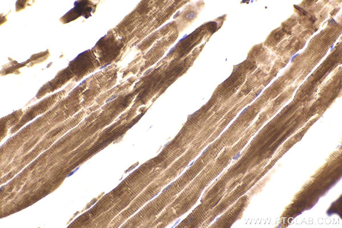 Immunohistochemical analysis of paraffin-embedded mouse skeletal muscle tissue slide using KHC2191 (ANK1 IHC Kit).