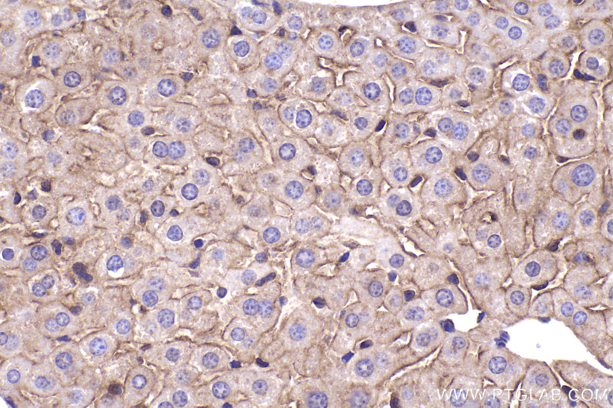 Immunohistochemical analysis of paraffin-embedded mouse liver tissue slide using KHC2357 (AP2B1 IHC Kit).