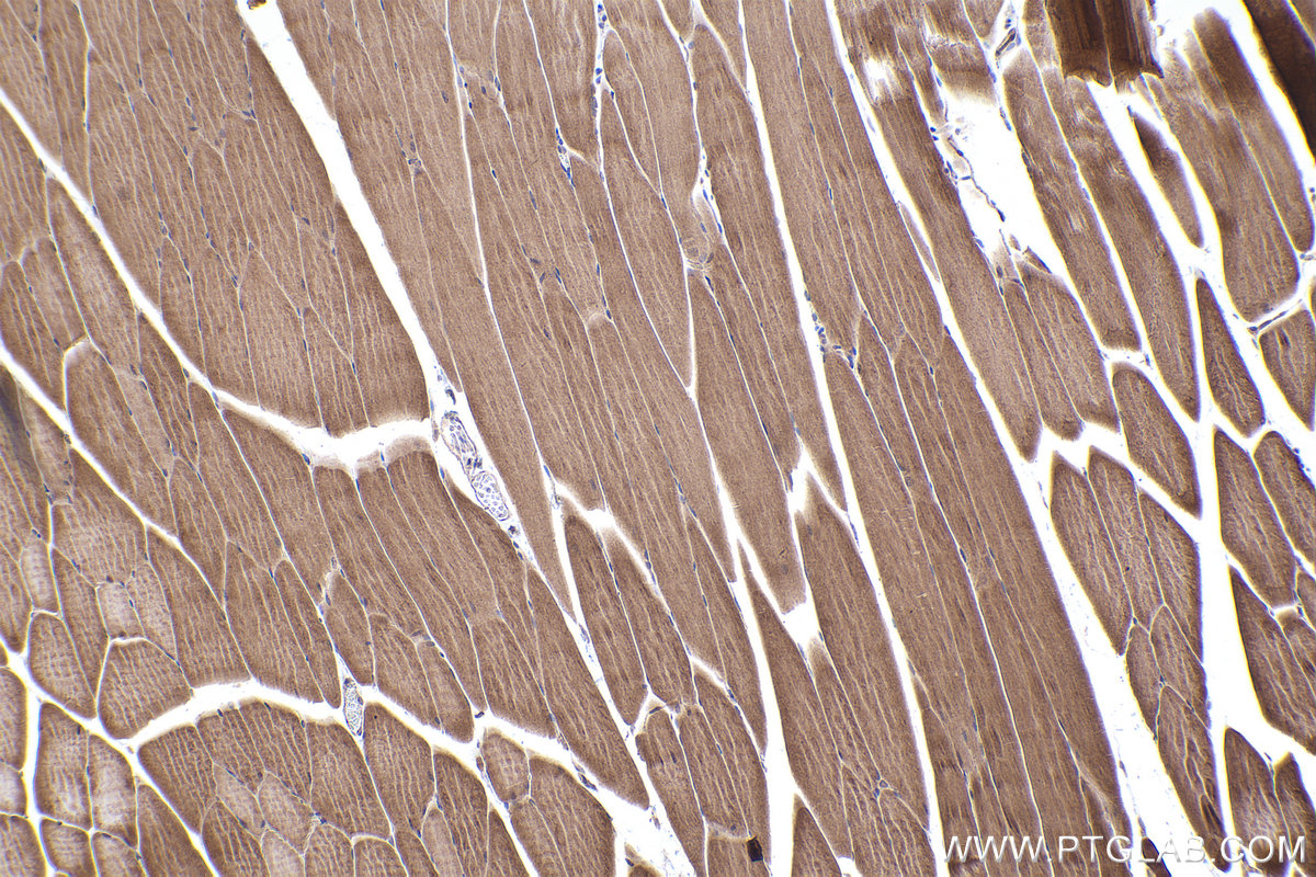 Immunohistochemical analysis of paraffin-embedded mouse skeletal muscle tissue slide using KHC2367 (ARG2 IHC Kit).