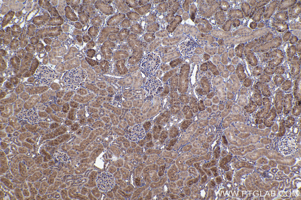 Immunohistochemical analysis of paraffin-embedded rat kidney tissue slide using KHC2367 (ARG2 IHC Kit).