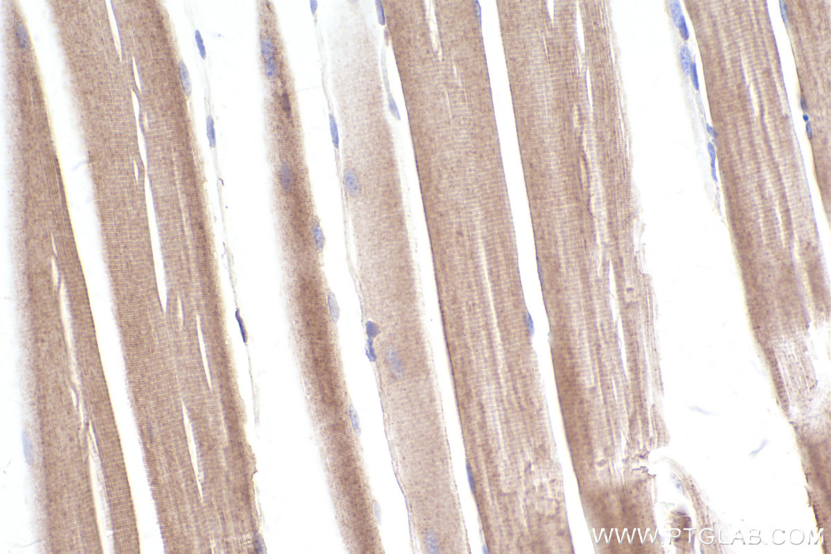 Immunohistochemical analysis of paraffin-embedded mouse skeletal muscle tissue slide using KHC2555 (ARHGAP21 IHC Kit).