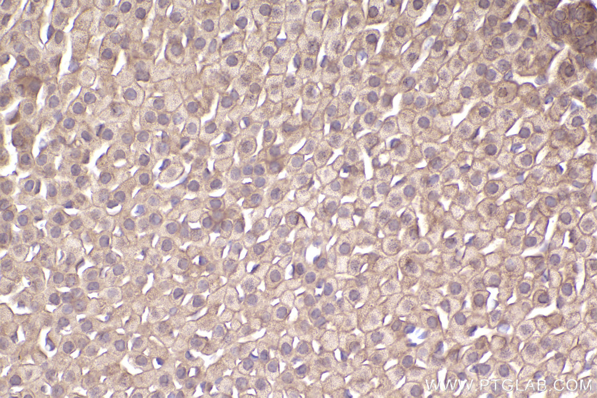 Immunohistochemical analysis of paraffin-embedded mouse adrenal gland tissue slide using KHC2555 (ARHGAP21 IHC Kit).