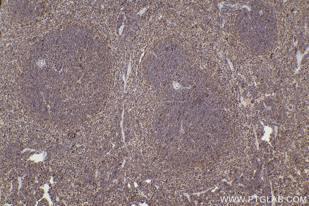 Immunohistochemical analysis of paraffin-embedded mouse spleen tissue slide using KHC2607 (ARHGAP27 IHC Kit).