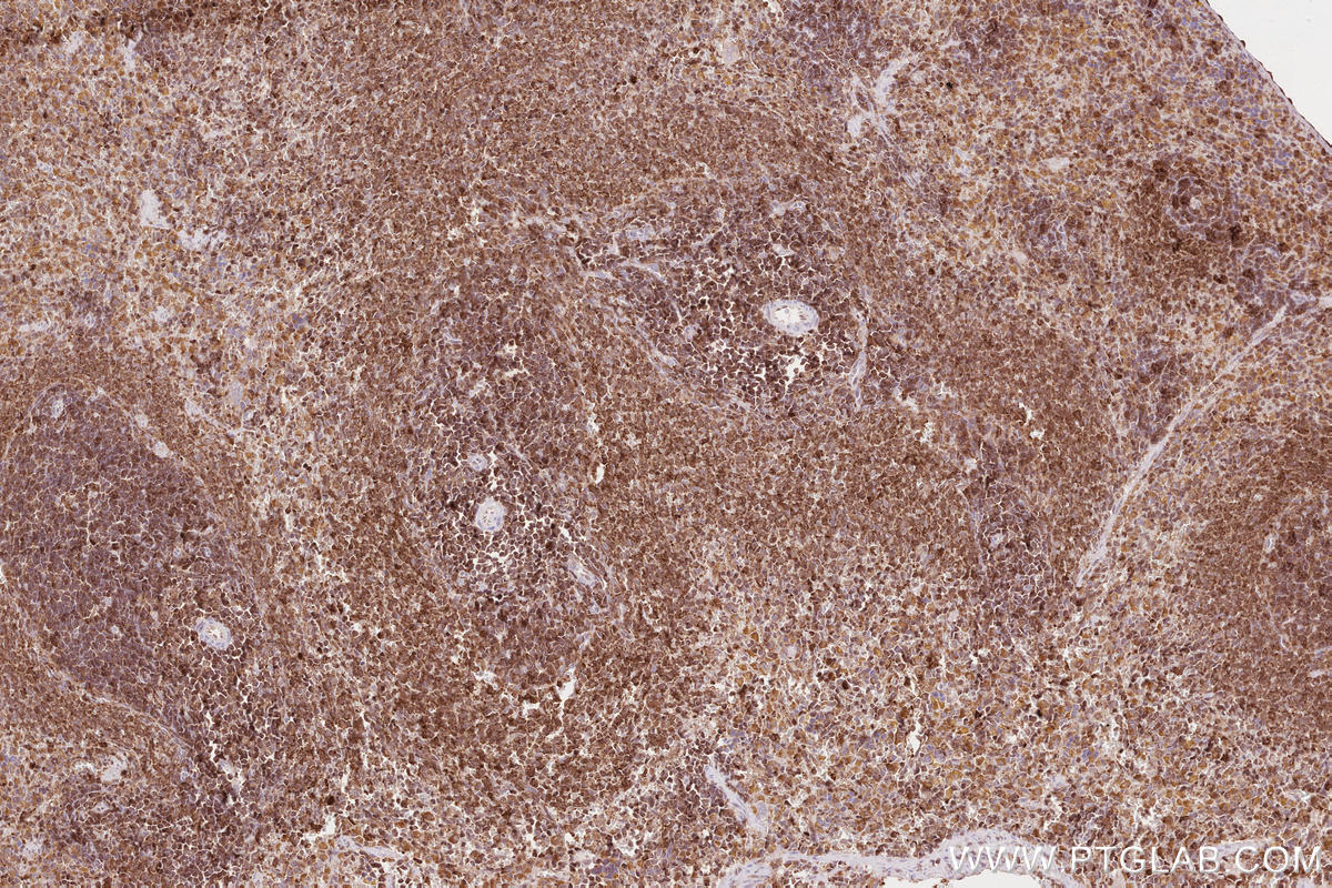 Immunohistochemical analysis of paraffin-embedded rat spleen tissue slide using KHC2607 (ARHGAP27 IHC Kit).