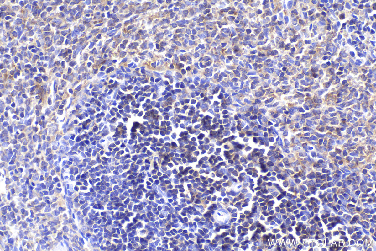 Immunohistochemical analysis of paraffin-embedded rat spleen tissue slide using KHC2405 (ARHGAP4 IHC Kit).