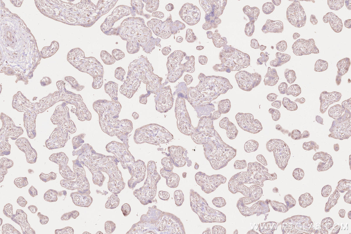 Immunohistochemical analysis of paraffin-embedded human placenta tissue slide using KHC2605 (ARHGEF18 IHC Kit).