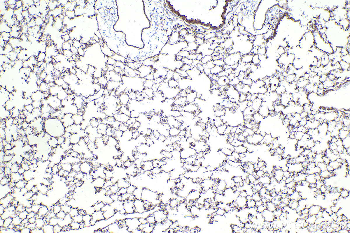 Immunohistochemical analysis of paraffin-embedded mouse lung tissue slide using KHC2449 (ARHGEF7 IHC Kit).