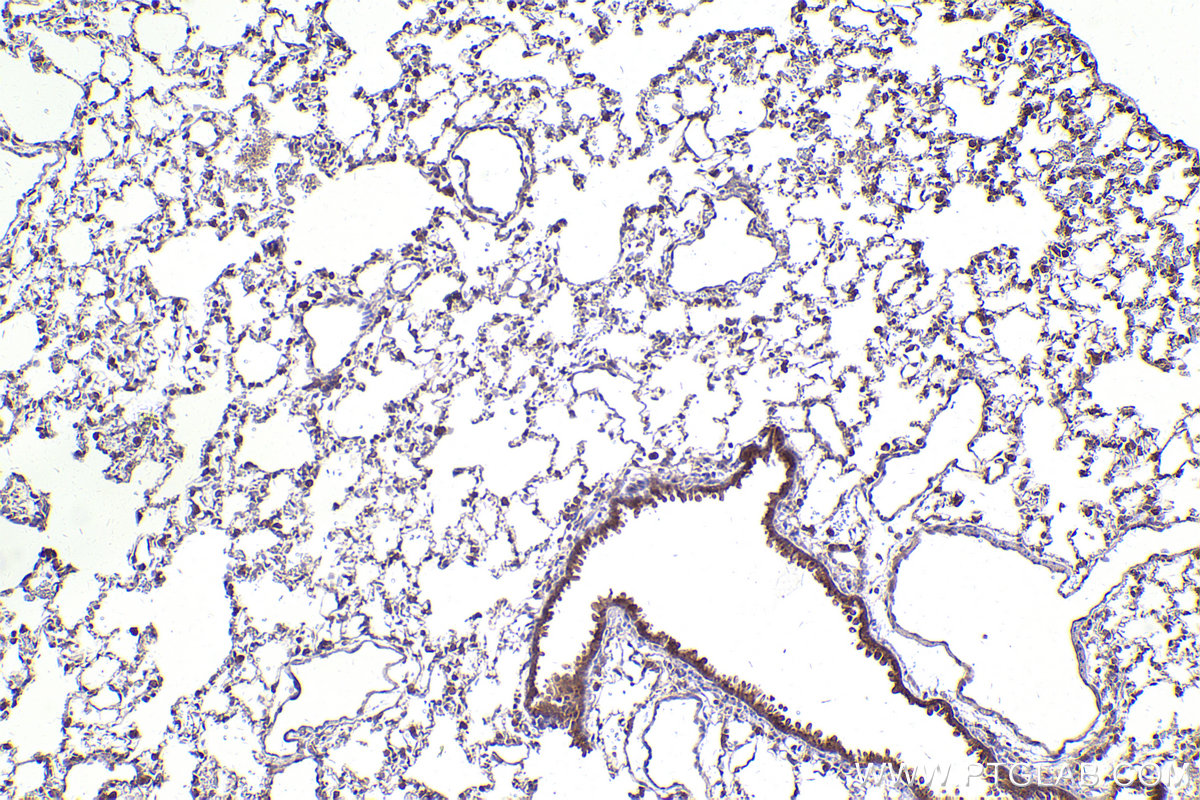 Immunohistochemical analysis of paraffin-embedded rat lung tissue slide using KHC2449 (ARHGEF7 IHC Kit).