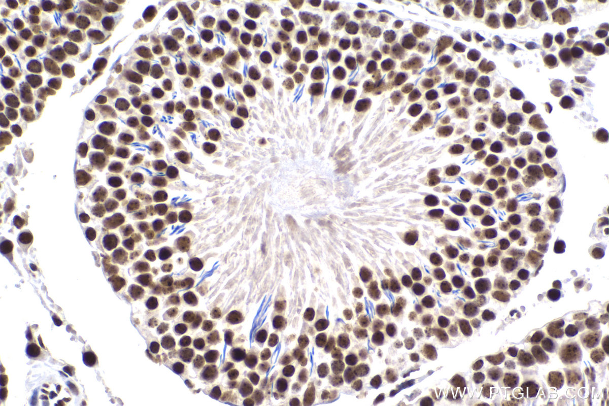 Immunohistochemical analysis of paraffin-embedded rat testis tissue slide using KHC2250 (ARL2 IHC Kit).