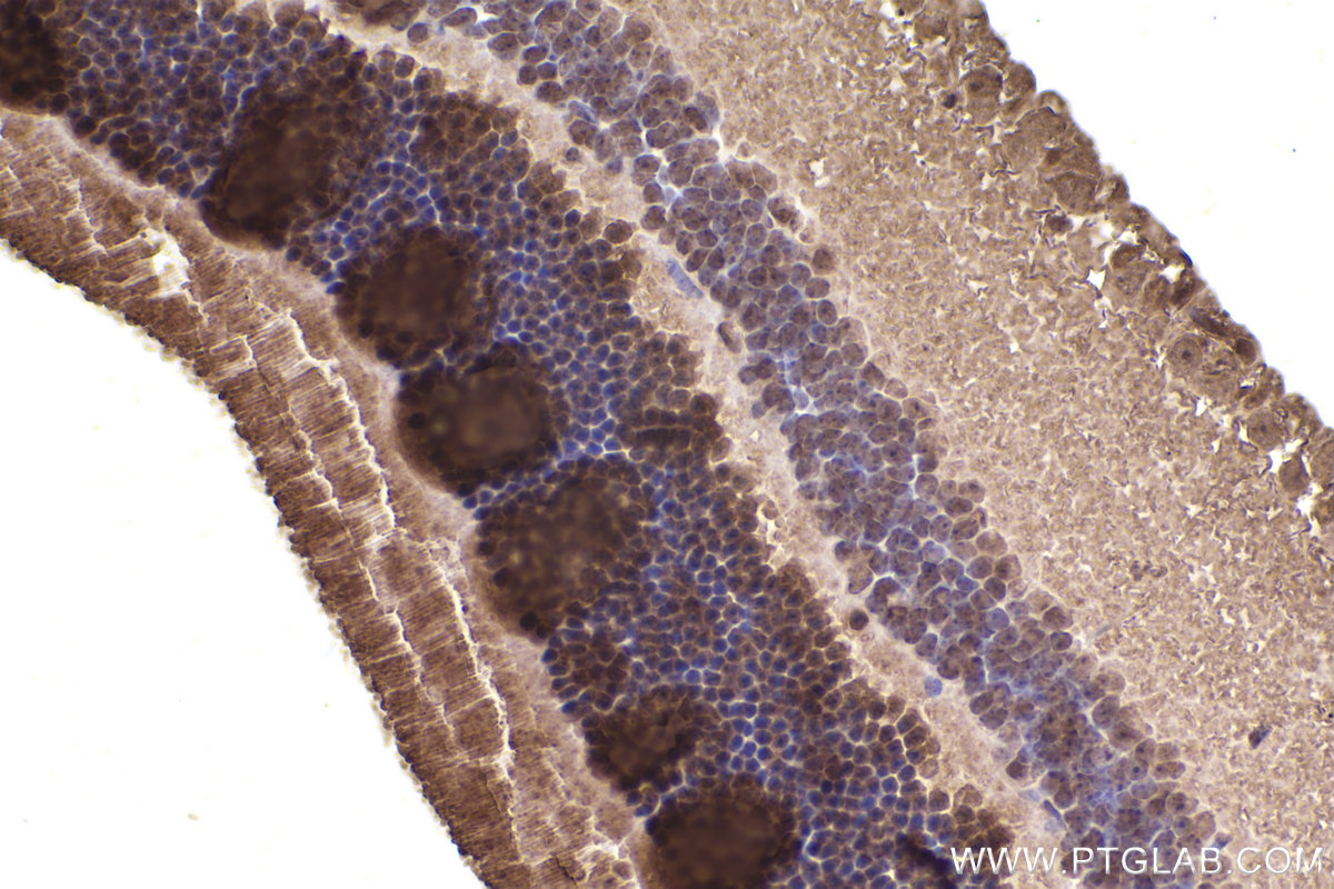 Immunohistochemical analysis of paraffin-embedded mouse eye tissue slide using KHC2251 (ARL3 IHC Kit).